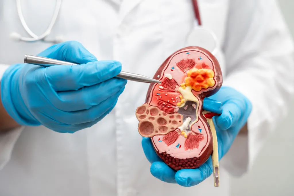 High Blood Sugar Damage Your Kidneys?